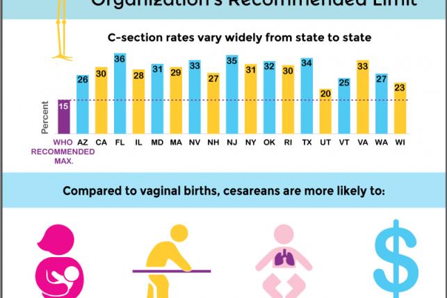 Cesarean Birth Rates in US